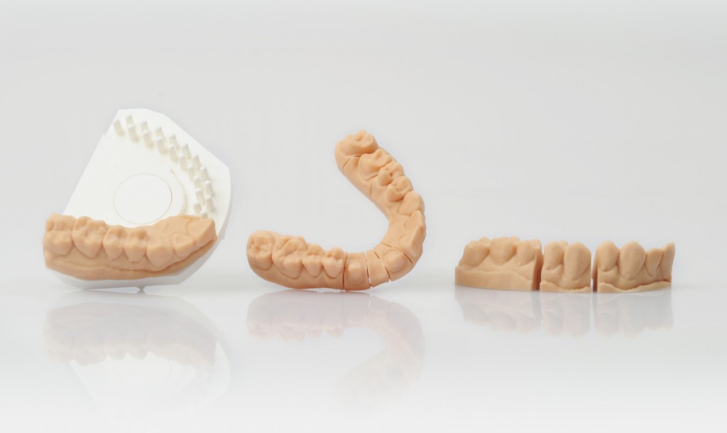 Design variety thanks to digital production: Complete jaw model in form of a solid piece to check for occlusions, saw-cut model with pinholes, model with removable stumps (left to right). Material: PA2105 (Image courtesy of EOS, Gmbh