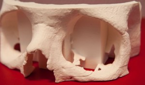3D Physical Skull Model (Photo courtesy of Mcor Technologies Ltd.)