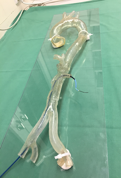 Transparent Stratasys 3D printed model of a patient-specific aortic arch, used by the University Hospital Mainz to practice complex endovascular surgeries. (Photo: Business Wire)