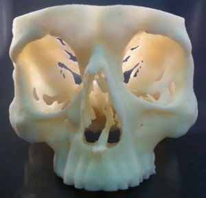 Cranium produced on a Stratasys Objet30 Pro 3D printer, used to validate patient surgery prior to the operation (Photo courtesy of Stratasys)