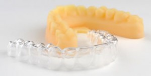Stratasys Objet Eden500V 3D Printers are an integral part of the production of ClearCorrect’s clear orthodontic aligners. (Photo courtesy of ClearCorrect/Stratasys Ltd.)