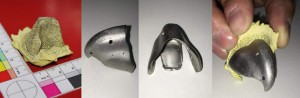 A part that saves lives: A 3D-printed titanium beak (Photo courtesy of Cicero Moraes)