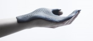 Windform 3D Printed Orthosis (Photo courtesy of CRP)