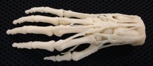 3D printed hand model for teaching, diagnosis, procedural planning. Digital file is a VA resource, hospitals can request models 3D printed on network printers for shipment. (Photo: Business Wire)