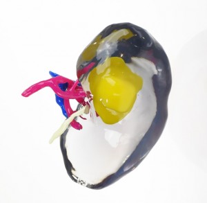 NYU School of Medicine leverages the Stratasys J750 to build multi-colored, 3D printed kidney cancer models (Photo: Business Wire)