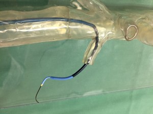 Surgeons use highly-accurate, transparent 3D printed model to practice the complex implant of a stent through the patient’s arteries. (Photo: Business Wire)