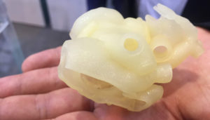 3D Printing in Medicine