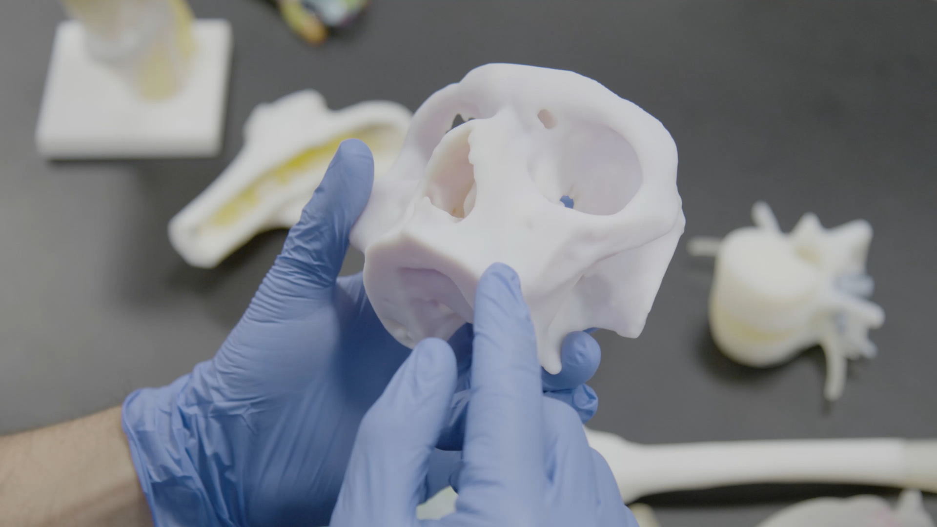 RICOH 3D for Healthcare has received 510(k) clearance from the FDA for its craniomaxillofacial and orthopedic patient-specific anatomic modeling.