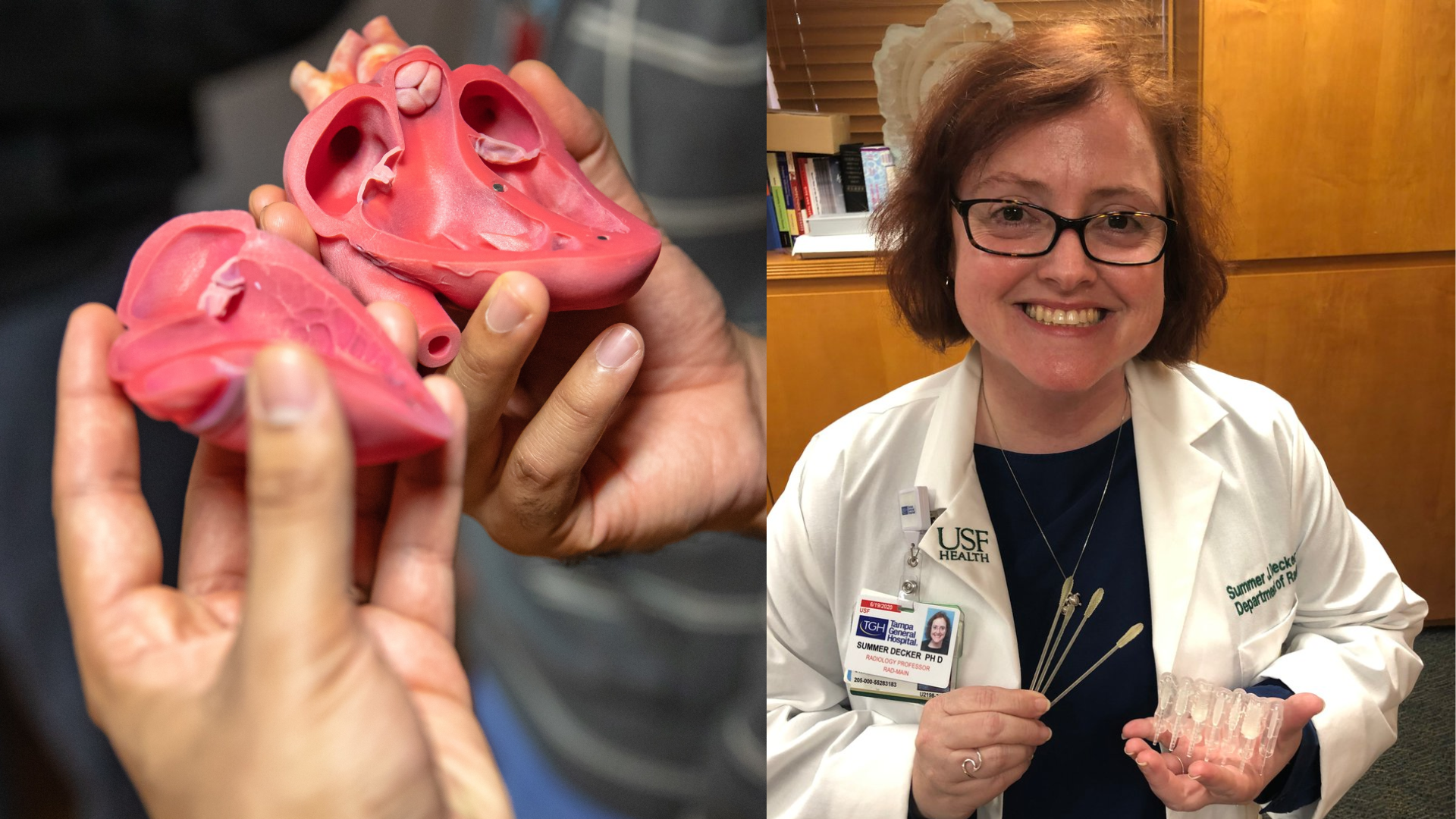 Doctors from Tampa General Hospital and USF Health Morsani College of Medicine use 3D printing to make anatomically correct replicas of a patient's heart or other organ to collaborate on a surgical strategy for that particular patient.