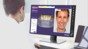DentalCAD 3.1 Rijeka released for labs and full-service clinics to optimize digital dentistry workflows for increased productivity.