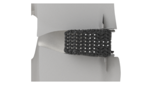 Nexus Spine announced the beta launch of Stable-C™, 3D printed cervical interbody fusion implants featuring integrated anchoring blades.