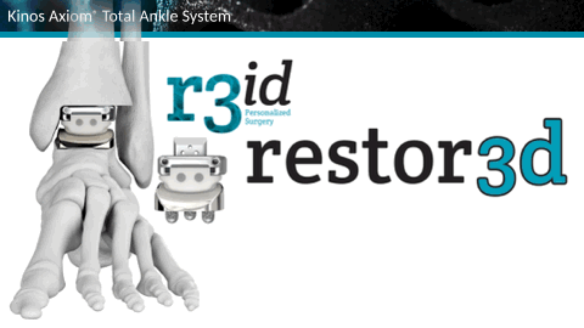Personalized Surgical SOlution: restor3d announced the successful implantation of 3D-printed Kinos Axiom® Total Ankle System.